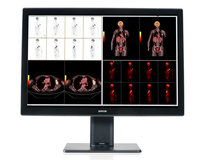 Monitor diagnostyczny